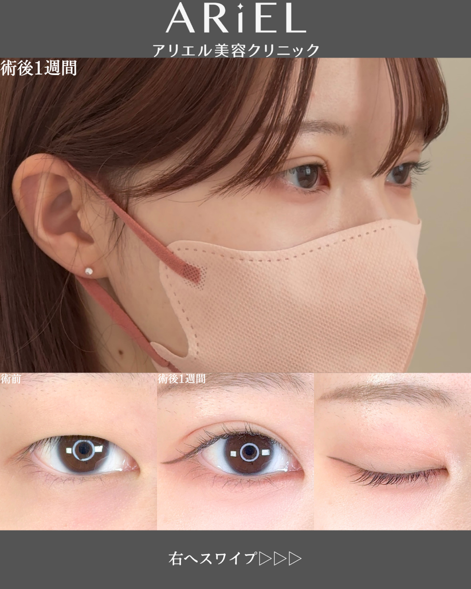 No.8633の症例写真